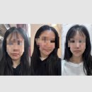 [인천 청라] 청라 메디컬 스킨케어 , 비선채 에스테틱 원데이 필링 후기