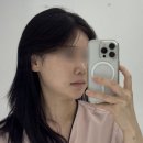 굿인소프트 | 실루엣소프트리프팅 유지 기간 지나서 닥터정리반에서 다시 받고 온 후기