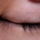 이앤김안과의원 이미지