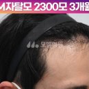 헤어라인 이미지