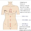 제니센의료기 이미지