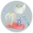 서울강남플란트치과의원 이미지