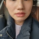 중앙기업의원 | 30대 피부관리,리프팅관리 | 슈링크유니버스(울트라) 후기,주기,유지기간 | 밴스의원광교