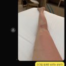 이레약국 | 필리핀 보홀 호핑투어 일광화상 썬번 후기 여행자보험