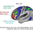 뇌량,전두엽,전전두엽 이미지