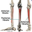 tibialis posterior dysfunction과 overpronation. 발의 재활에 대해서 이미지