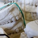 더꼼꼼한치과의원 | 치아교정 시작 전후, 꼼꼼한 치석 제거가 왜 중요할까요? 대전 치과 방문 후기