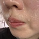 힐링온열다이어트