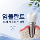 화명역치과 임플란트 수명 얼마나 갈까요? 오래 사용하는 관리방법까지 알려드립니다