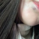 큐티멍 | 국산필러 큐티필 입술필러 1cc후기 내돈내산 비대칭입술 입술필러멍 입술필러붓기 입술필러후기
