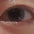 굿아이금천이안과