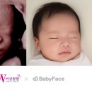 인천우리병원 | 우리아기 얼굴 미리보기, 베이비페이스 후기(w여성병원 인천)