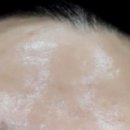 리프업의원 | 세월의 흔적에 갇힌 듯한 내 모습, 입술 필러로 당당하게 변화해요!