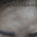 삼성프렌드의원 네이버블로그