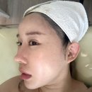 화정피부관리 이아소에스테틱 안면비대칭관리 후기