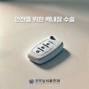 광주백내장 수술 안과 이미지