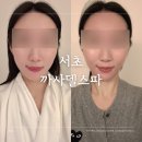 서초대로53길 15 | 서초 까사델스파 윤곽관리 교대역 산전산후관리 후기