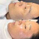 연세메디칼약국 | [공지] 인천슈퍼젝션, 피부 탄력이 고민이라면 ‘이것’부터 체크하세요