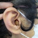 포낙보청기 이미지