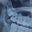 롯데리아비래점 | 첫 음이 어디였었더라 🎶