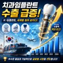욜로캠프(구 인디캠프) | 치과 임플란트 수출 3단계 완벽정리! 나만 몰랐던 텐배거
