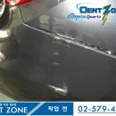 덴트존 이미지