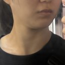 베러미의원 | 잠실새내역피부과 베러미의원 잠실 온다 후기 이중턱 효과