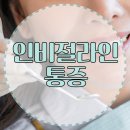 인비절라인 교정 통증 정도는 얼마나 될까? 일반 철사 교정 장치와의 비교 분석