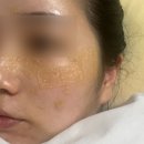 능곡예인의원 네이버블로그