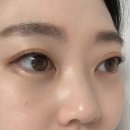브나다 | 대구 반월당 속눈썹펌 잘하는 곳 '브나다' 클리닉펌 후기