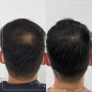 두피를디자인하는여자 네이버블로그