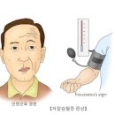 칼륨부족 저칼륨혈증 / 칼륨수치 과다 고칼륨혈증 이미지