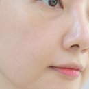 (주)티메드솔루션 | 모공앰플 추천 메디솝 필링 트리트먼트 앰플로 깐달걀피부 만든 후기