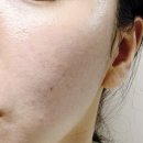 몬퓨리엘 올인원 갈바닉 냉온 마사지기 2주 후기