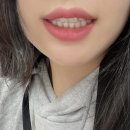 라이트 메디텍 이미지