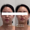 마노아(MANOAH) | 청주비대칭교정 체형분석까지 신기한 호흡테라피 마노아뷰티!