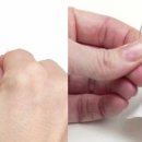 100세 보청기 이미지