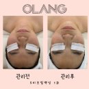 베네핏 에스테틱 이미지