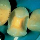 본치과기공소 이미지