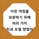삼아치과기공소 | 이런 약점을 보완하기 위해 여러 가지 치과 보철 방법이