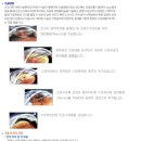정화선안과