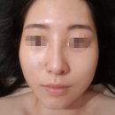 명륜동 여드름 관리 [거꾸로 가는 시간 따뚜점] 후기🥚