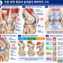 무릎 앞쪽이 아프다면? 슬개골 키네시오 테이핑 방법과 무릎통증의 원인. 이미지