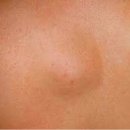 아이앤유 이미지