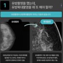 강남아름다운유외과의원 | [1.1] 강남 유방 확대 촬영 하는 병원, 강남아름다운유외과 후기