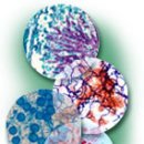 Normal Ranges for Common Laboratory Tests 이미지