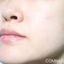 바이퓨어 이미지