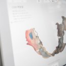 대구디지털치과기공소 이미지