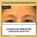 노블와이성형외과의원 이미지