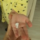 리프테라피